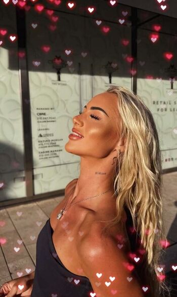 🔥 Alisha lehmann  page leaked private photo uncensored full