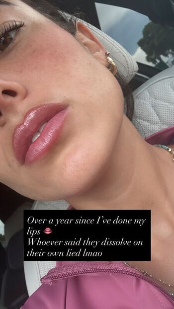 🔥 Angie varona  page leaked private photo uncensored full