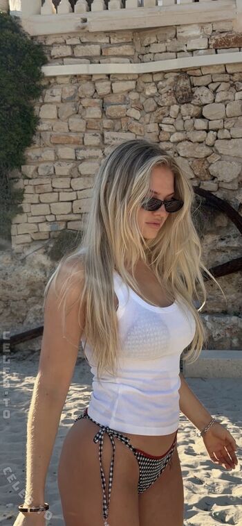 🔥 Emilia wue page leaked private photo uncensored full