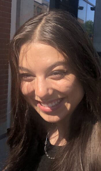 🔥 Kira kosarin  page leaked private photo uncensored full