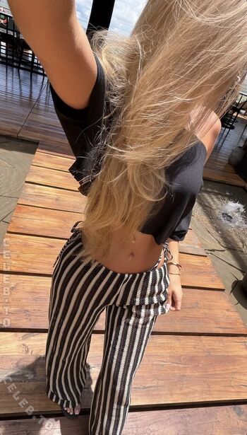 🔥 Zoe kaeppele  page leaked private photo uncensored full